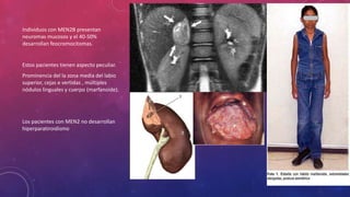 Individuos con MEN2B presentan
neuromas mucosos y el 40-50%
desarrollan feocromocitomas.
Estos pacientes tienen aspecto peculiar.
Prominencia del la zona media del labio
superior, cejas e vertidas , múltiples
nódulos linguales y cuerpo (marfanoide).
Los pacientes con MEN2 no desarrollan
hiperparatiroidismo
 