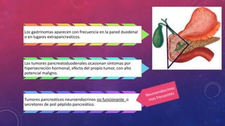 Los gastrinomas aparecen con frecuencia en la pared duodenal
o en lugares extrapancreaticos.
Los tumores pancreatoduodenales ocasionan síntomas por
hipersecreción hormonal, efecto del propio tumor, con alto
potencial maligno.
Tumores pancreáticos neuroendocrinos no funcionante o
secretores de poli péptido pancreático.
 