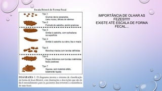 IMPORTÂNCIA DE OLHAR AS
FEZES!!!!!!
EXISTE ATÉ ESCALA DE FORMA
FECAL...
 