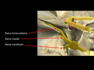 Rama fronto-orbitaria
Rama maxilar
Rama mandibular
 