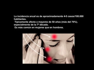 La incidencia anual es de aproximadamente 4-5 casos/100.000
habitantes.
Típicamente afecta a mayores de 50 años (más del 70%),
especialmente de la 7ª década.
Es más común en mujeres que en hombres.
 