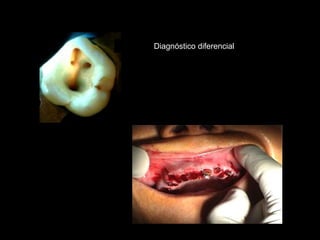 Diagnóstico diferencial
 