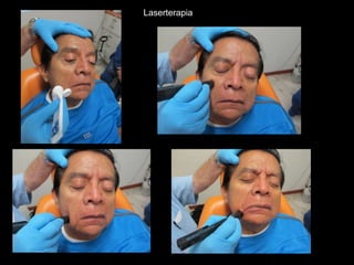 Laserterapia
 