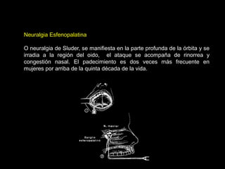 Neuralgia Esfenopalatina
O neuralgia de Sluder, se manifiesta en la parte profunda de la órbita y se
irradia a la región del oido, el ataque se acompaña de rinorrea y
congestión nasal. El padecimiento es dos veces más frecuente en
mujeres por arriba de la quinta década de la vida.
 