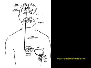 Vías de trasmisión del dolor
 