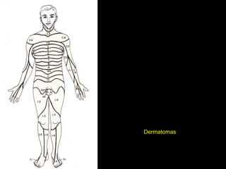 Dermatomas
 