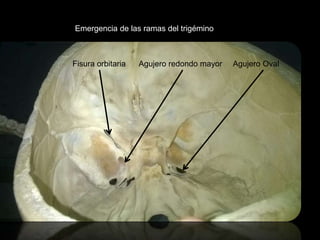 Fisura orbitaria Agujero redondo mayor Agujero Oval
Emergencia de las ramas del trigémino
 