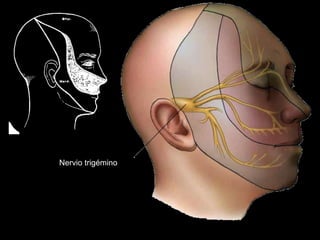 Nervio trigémino
 