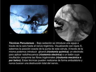 Técnicas Percutaneas .: Bajo sedación se introduce una aguja a
través de la cara hasta el nervio trigémino. Visualizando con rayos X,
sabemos la posición exacta de la punta de esta cánula. A través de la
misma podemos introducir glicerol (rizotomía quimica), un electrodo
para aplicar radiofrecuencia (rizotomía electrica) o un balón cuya
insuflación comprime las fibras trigéminales (rizotomia mecánica o
por balon). Estas técnicas pueden realizarse de forma ambulatoria y
nunca buscan una destrucción total del nervio.
 