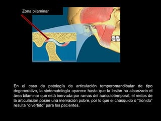 Zona bilaminar
En el caso de patología de articulación temporomandibular de tipo
degenerativo, la sintomatología aparece hasta que la lesión ha alcanzado el
área bilaminar que está inervada por ramas del auriculotemporal, el restos de
la articulación posee una inervación pobre, por lo que el chasquido o “tronido”
resulta “divertido” para los pacientes.
 