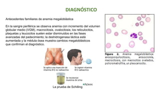 Antecedentes familiares de anemia megaloblástica
En la sangre periférica se observa anemia con incremento del volumen
globular medio (VGM), macrocitosis, ovalocitosis; los reticulocitos,
plaquetas y leucocitos suelen estar disminuidos en las fases
avanzadas del padecimiento; la deshidrogenasa láctica está
aumentada y la médula ósea muestra cambios megaloblásticos
que confirman el diagnóstico.
La prueba de Schilling
DIAGNÓSTICO
 