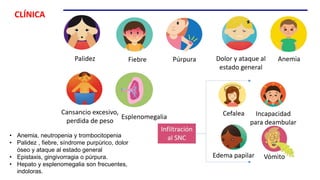 • Anemia, neutropenia y trombocitopenia
• Palidez , fiebre, síndrome purpúrico, dolor
óseo y ataque al estado general
• Epistaxis, gingivorragia o púrpura.
• Hepato y esplenomegalia son frecuentes,
indoloras.
CLÍNICA
 