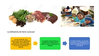 La deficiencia de hierro cursa por
en las primeras, hay
disminución de los depósitos
del metal; el Fe sérico se
mantiene en cifras normales y
no se hace evidente la
anemia
en estados intermedios se
abaten los niveles de Fe
sérico y hace su aparición la
anemia
en fases tardías, se acentúa
la anemia y se establecen los
datos de deficiencia de Fe a
nivel tisula
 