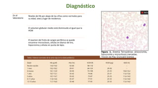 Diagnóstico
En el
laboratorio
Niveles de Hb por abajo de las cifras como normales para
su edad, sexo y lugar de residencia.
El volumen globular medio está disminuido al igual que la
HCM
El examen del frotis de sangre periférica se puede
encontrar microcitosis, células en blanco de tiro,
hipocromía y células en punta de lápiz.
 