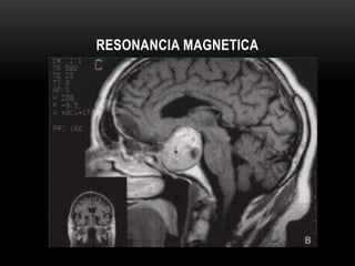 RESONANCIA MAGNETICA 
 