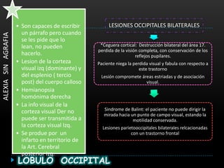 • Son capaces de escribir         LESIONES OCCIPITALES BILATERALES
                       un párrafo pero cuando
ALEXIA SIN AGRAFIA



                       se les pide que lo
                       lean, no pueden             *Ceguera cortical: Destrucción bilateral del área 17.
                                                  perdida de la visión completa, con conservación de los
                       hacerlo.                                      reflejos pupilares.
                     • Lesion de la corteza       Paciente niega la perdida visual y fabula con respecto a
                       visual izq (dominante) y                        este trastorno
                       del esplenio ( tercio       Lesión compromete áreas estriadas y de asociación
                       post) del cuerpo calloso                        visual.
                     • Hemianopsia
                       homónima derecha
                     • La info visual de la
                                                     Sindrome de Balint: el paciente no puede dirigir la
                       corteza visual Der no         mirada hacia un punto de campo visual, estando la
                       puede ser transmitida a                     motilidad conservada.
                       la corteza visual Izq.       Lesiones parietooccipitales bilaterales relcacionadas
                     • Se produe por un                           con un trastorno frontal
                       infarto en territorio de
                       la Art. Cerebral
                       posterior Izq.
                     LOBULO OCCIPITAL
 