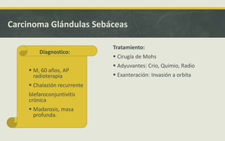 Diagnostico:
 Tiempo de DX: 1 año
 BX
 Celulas pleomorficas
desproporcion N-C,
mitosis, grasa.
Carcinoma Glándulas Sebáceas
Diagnostico:
 M, 60 años, AP
radioterapia
 Chalazión recurrente
blefaroconjuntivitis
crónica
 Madarosis, masa
profunda.
Tratamiento:
 Cirugía de Mohs
 Adyuvantes: Crio, Quimio, Radio
 Exanteración: Invasión a orbita
 