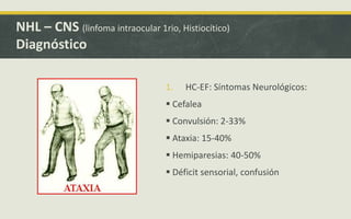 1. HC-EF: Síntomas Neurológicos:
 Cefalea
 Convulsión: 2-33%
 Ataxia: 15-40%
 Hemiparesias: 40-50%
 Déficit sensorial, confusión
NHL – CNS (linfoma intraocular 1rio, Histiocítico)
Diagnóstico
 
