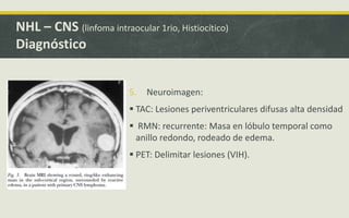 5. Neuroimagen:
 TAC: Lesiones periventriculares difusas alta densidad
 RMN: recurrente: Masa en lóbulo temporal como
anillo redondo, rodeado de edema.
 PET: Delimitar lesiones (VIH).
NHL – CNS (linfoma intraocular 1rio, Histiocítico)
Diagnóstico
 