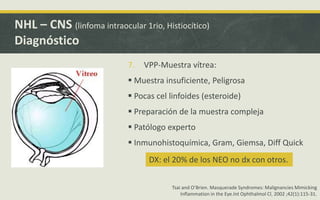 7. VPP-Muestra vítrea:
 Muestra insuficiente, Peligrosa
 Pocas cel linfoides (esteroide)
 Preparación de la muestra compleja
 Patólogo experto
 Inmunohistoquímica, Gram, Giemsa, Diff Quick
NHL – CNS (linfoma intraocular 1rio, Histiocítico)
Diagnóstico
DX: el 20% de los NEO no dx con otros.
Tsai and O’Brien. Masquerade Syndromes: Malignancies Mimicking
Inflammation in the Eye.Int Ophthalmol Cl. 2002 ;42(1):115-31.
 