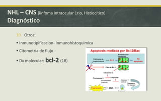 10. Otros:
 Inmunotipificacion- Inmunohistoquimica
 Citometria de flujo
 Dx molecular: bcl-2 (18)
NHL – CNS (linfoma intraocular 1rio, Histiocítico)
Diagnóstico
 