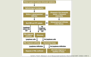 Korfel A, Thiel E, Nikolaos E. et al. Masquerade Syndrome. Dtsch Arztebl 2007; 104(8): A 490–5.
 