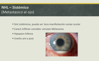 NHL – Sistémico
(Metastasico al ojo)
 Sint sistémicos, puede ser 1era manifestación compr ocular
 Caract infiltran coroides: simulan Melanoma
 Hipopion-hifema
 Uveitis ant o post
 