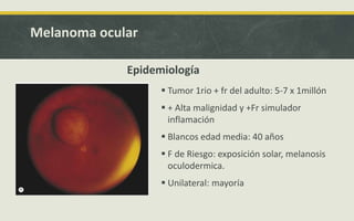 Melanoma ocular
 Tumor 1rio + fr del adulto: 5-7 x 1millón
 + Alta malignidad y +Fr simulador
inflamación
 Blancos edad media: 40 años
 F de Riesgo: exposición solar, melanosis
oculodermica.
 Unilateral: mayoría
Epidemiología
 