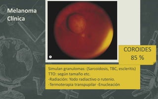 Melanoma
Clínica
COROIDES
85 %
Simulan granulomas: (Sarcoidosis, TBC, escleritis)
TTO: según tamaño etc.
-Radiación: Yodo radiactivo o rutenio.
-Termoterapia transpupilar -Enucleación
 