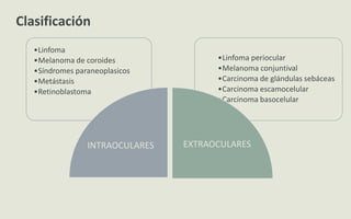 •Linfoma periocular
•Melanoma conjuntival
•Carcinoma de glándulas sebáceas
•Carcinoma escamocelular
•Carcinoma basocelular
•Linfoma
•Melanoma de coroides
•Síndromes paraneoplasicos
•Metástasis
•Retinoblastoma
INTRAOCULARES EXTRAOCULARES
Clasificación
 