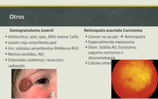 Otros
Xantogranuloma Juvenil
 Histiocitico: piel, ojos, 80% menor 1año
 Lesión rojo amarillenta piel
 Iris: nódulos amarillentosHifemaGl
 Retina-coroides, NO
 Esteroides sistémico, resección,
radiación.
Retinopatía asociada Carcinoma
 Cáncer no ocular  Retinopatía
 Especialmente melanoma
 Dism. Súbita AV, Escotoma,
ceguera nocturna o
discromatopsia
 Células vítreo
 