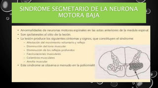 SINDROME SEGMETARIO DE LA NEURONA
MOTORA BAJA
 