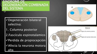 SÍNDROME DE
DEGENERACIÓN COMBINADA
DEL SISTEMA
Degeneración bilateral
selectiva:
1. Columna posterior
2.Fascículo espinotalamico
Perdida de propiocepción
Afecta la neurona motora
alta
 