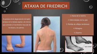 ATAXIA DE FRIEDRICH
 