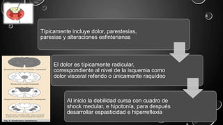 Típicamente incluye dolor, parestesias,
paresias y alteraciones esfinterianas
El dolor es típicamente radicular,
correspondiente al nivel de la isquemia como
dolor visceral referido o únicamente raquídeo
Al inicio la debilidad cursa con cuadro de
shock medular, e hipotonía, para después
desarrollar espasticidad e hiperreflexia
 