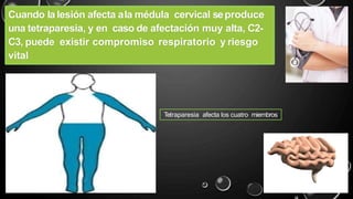 Cuando la lesión afecta ala médula cervical seproduce
una tetraparesia, y en caso de afectación muy alta, C2-
C3, puede existir compromiso respiratorio y riesgo
vital
Tetraparesia afecta los cuatro miembros
 