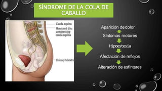 SÍNDROME DE LA COLA DE
CABALLO
Síntomas motores
Hipoestesia
Afectación de reflejos
Alteración de esfínteres
Aparición dedolor
 