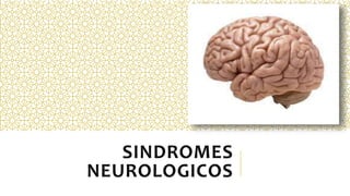SINDROMES
NEUROLOGICOS
 