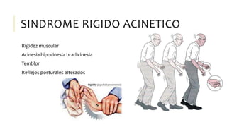 SINDROME RIGIDO ACINETICO
Rigidez muscular
Acinesia hipocinesia bradicinesia
Temblor
Reflejos posturales alterados
 