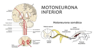 MOTONEURONA
INFERIOR
 
