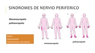SINDROMES DE NERVIO PERIFERICO
Mononeuropatia
polineuropatia
mononeuropatia
polineuropatia
Dolor
Hipoestesia
Transtornos vasculares
 