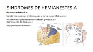 SINDROMES DE HEMIANESTESIA
Hemianestesia Cortical:
transtornos sensitivos predominan en la cara e extremidad superor
Predominio de perdida sensibilidad táctil, grafiestesia y
discriminación de dos puntos
Negligencia somatoestesica
 