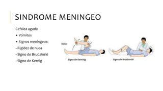 SINDROME MENINGEO
Cefalea aguda
• Vómitos
• Signos meníngeos:
–Rigidez de nuca
–Signo de Brudzinski
–Signo de Kernig
 