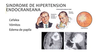 SINDROME DE HIPERTENSION
ENDOCRANEANA
Cefalea
Vómitos
Edema de papila
 