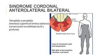 SINDROME CORDONAL
ANTEROLATERAL BILATERAL
Tetraplejia o paraplejia
Anestesia superficial termico dolorosa
Conservación sensibilidad tactil y
profunda
 