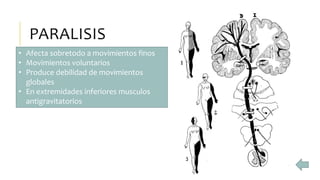PARALISIS
• Afecta sobretodo a movimientos finos
• Movimientos voluntarios
• Produce debilidad de movimientos
globales
• En extremidades inferiores musculos
antigravitatorios
 