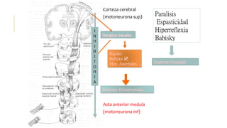 Corteza cerebral
(motoneurona sup)
Asta anterior medula
(motoneurona inf)
Paralisis
Espasticidad
Hiperreflexia
Babisky
Sindrome Piramidal
Ganglios basales
Rigidez
Reflejos ☑
Mov. Anormales
Sindrome Extrapiramidal
I
N
H
I
B
I
T
O
R
I
A
 