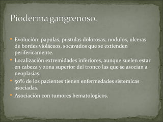 Evolución: papulas, pustulas dolorosas, nodulos, ulceras de bordes violáceos, socavados que se extienden perifericamente.  Localización extremidades inferiores, aunque suelen estar en cabeza y zona superior del tronco las que se asocian a neoplasias. 50% de los pacientes tienen enfermedades sistemicas asociadas.  Asociación con tumores hematologicos.  