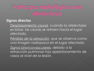 Signos directos
 Desplazamiento cisural, cuando la atelectasia
es lobar, las cisuras se retraen hacia el lugar
afectado.
 Pérdida de la aireación, que se observa como
una imagen radiopaca en el lugar afectado.
 Signos broncovasculares, debido a la
retracción pulmonar hay apelotonamiento de
vasos al nivel de la lesión.
 