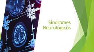 Síndromes
Neurológicos
 